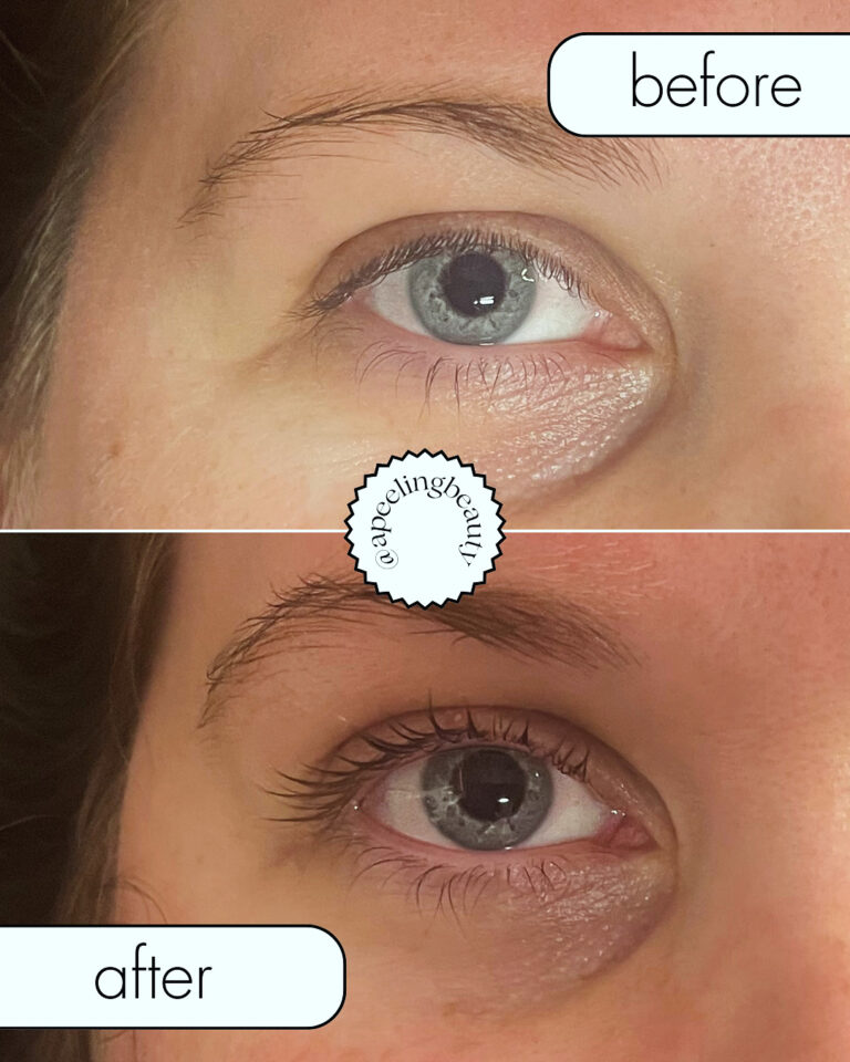 1774A778 976C 4CC3 BCEE 3208A9C5D233 768x960